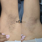 Depilación de Axilas con Cera Profesional